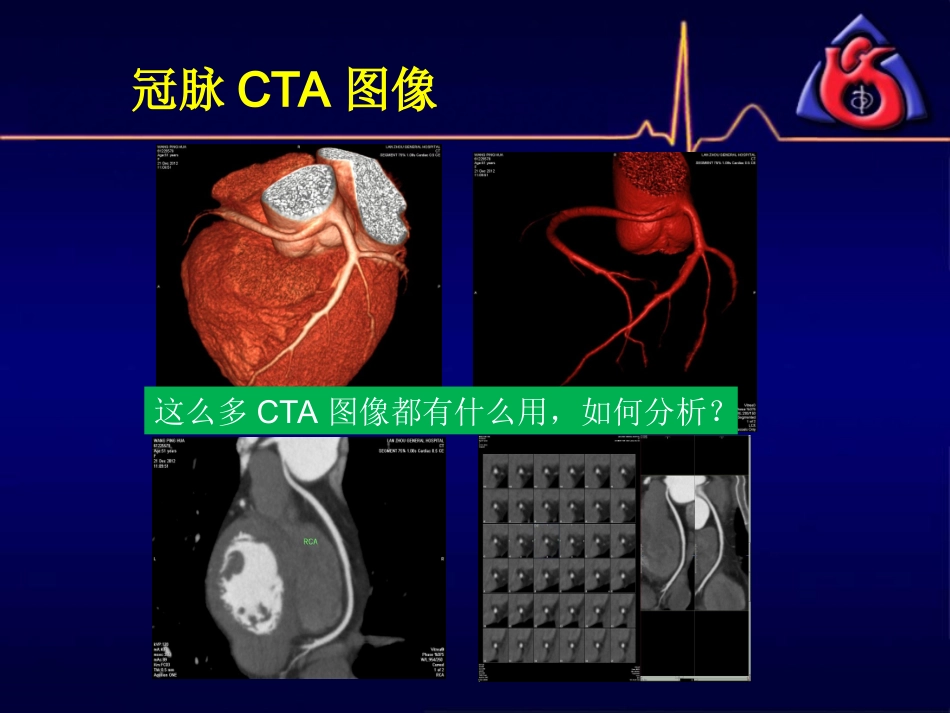 冠脉CTA读片(非常经典)_第3页