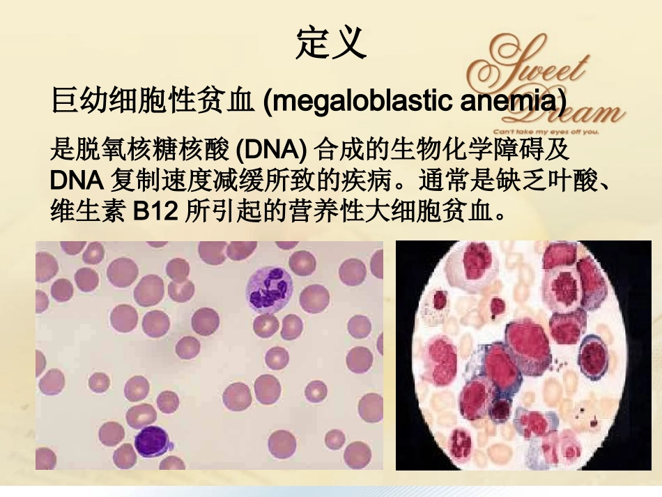 巨幼细胞性贫血_第3页