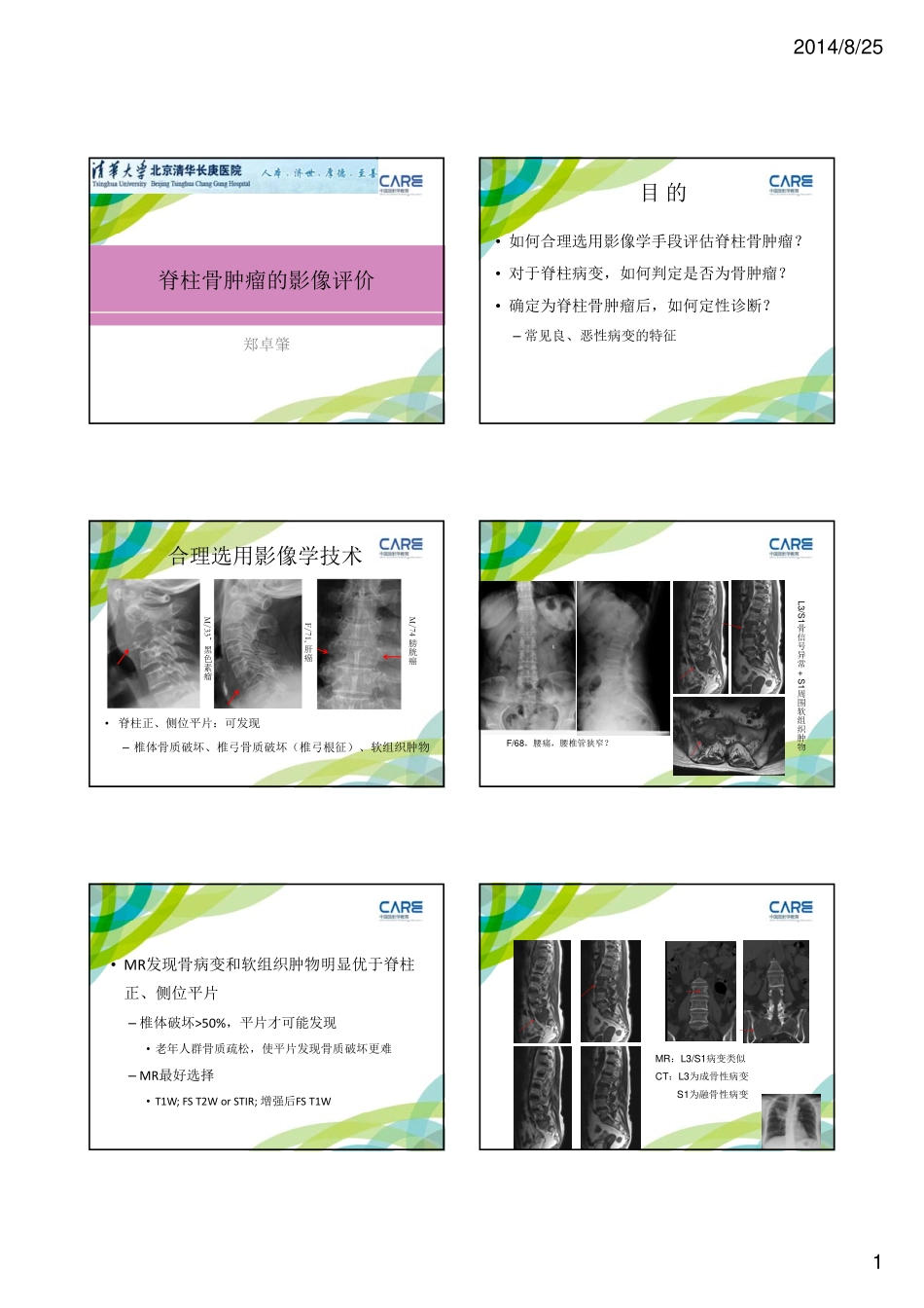 脊柱骨肿瘤的影像 ---郑卓肇_第1页