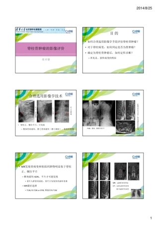 脊柱骨肿瘤的影像 ---郑卓肇