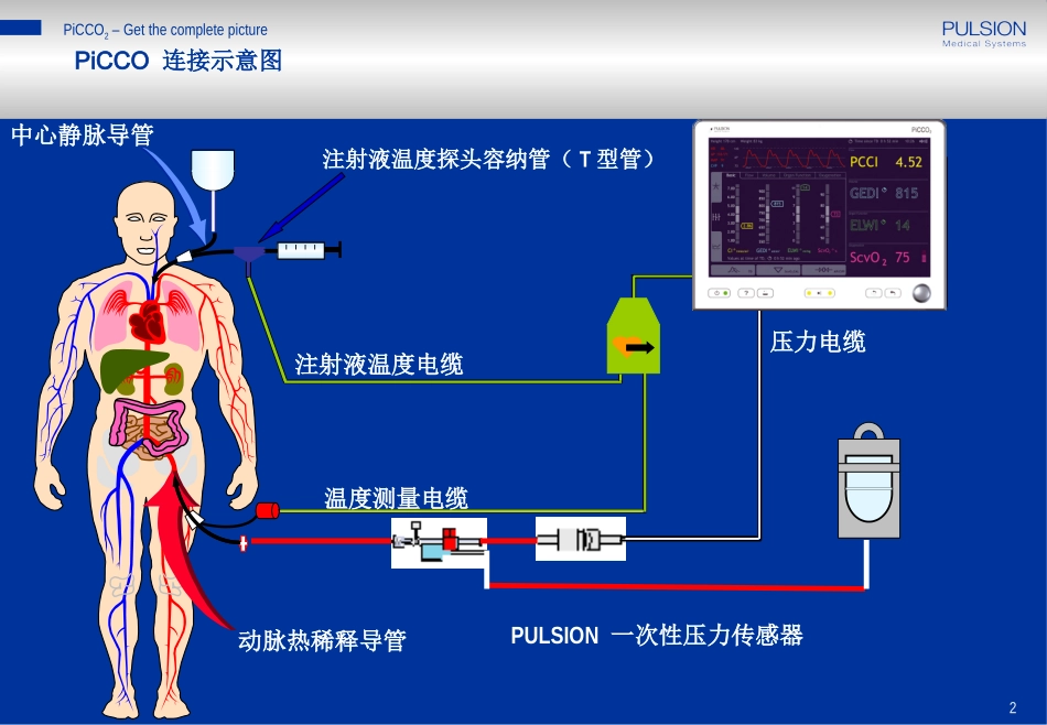 PiCCO参数解读-阜外医院_第2页