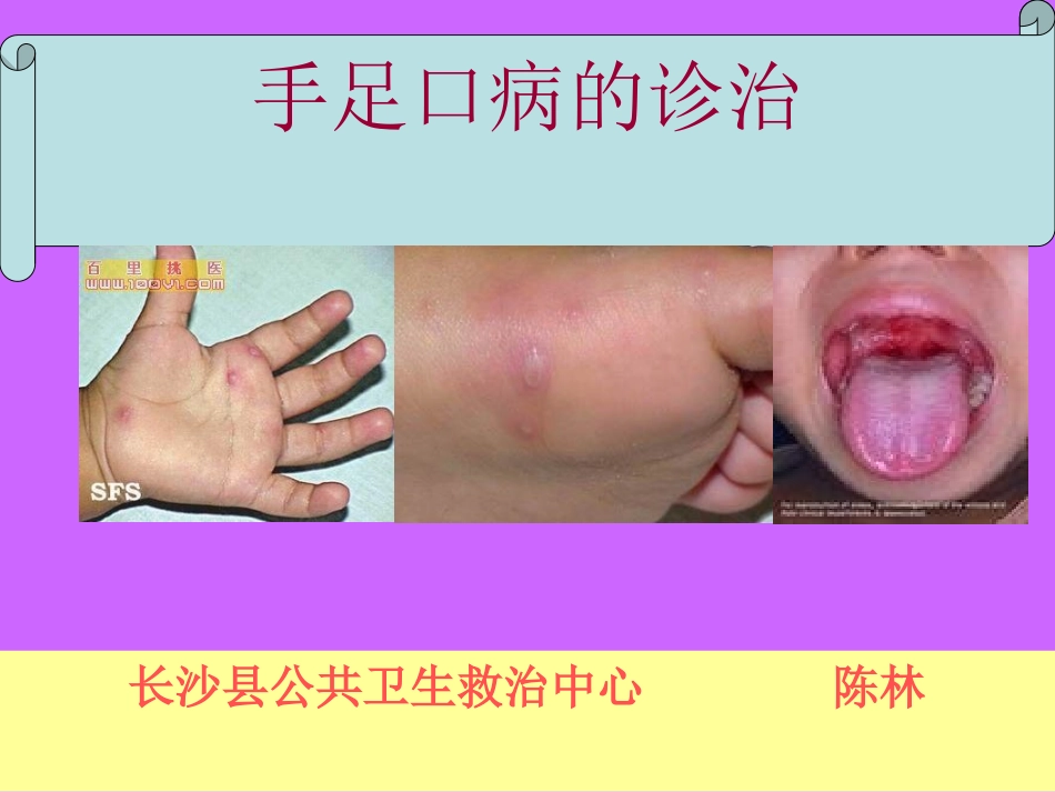 手足口病.的诊治_第1页