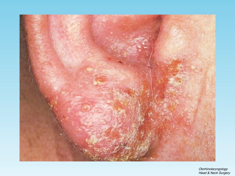 耳科疾病(一)2016_第3页