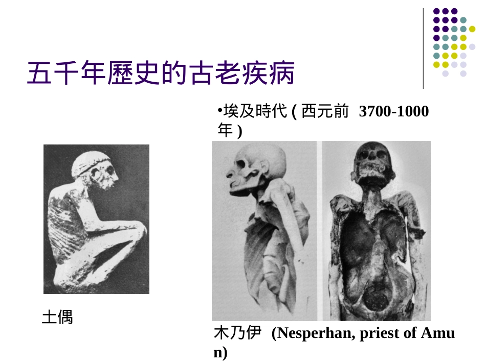 校园结核病防治_第3页