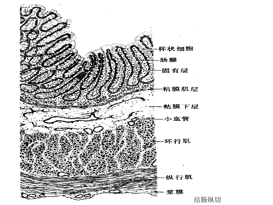 炎症性肠病讲课_第3页
