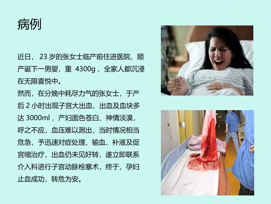 产后出血-教学版_第2页