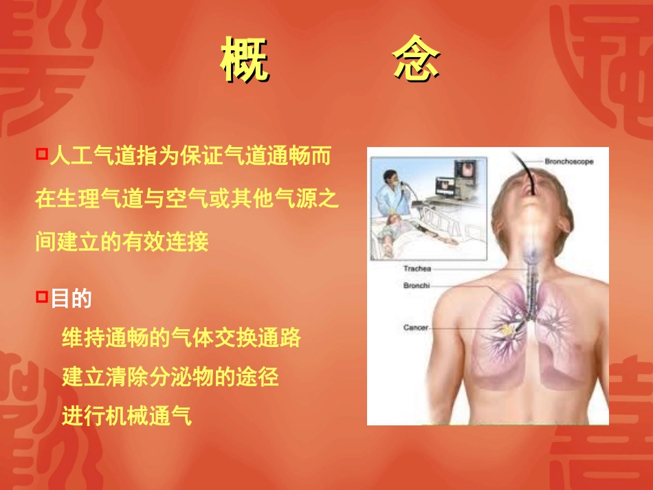 人工气道的建立与_第2页