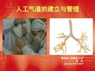 人工气道的建立与