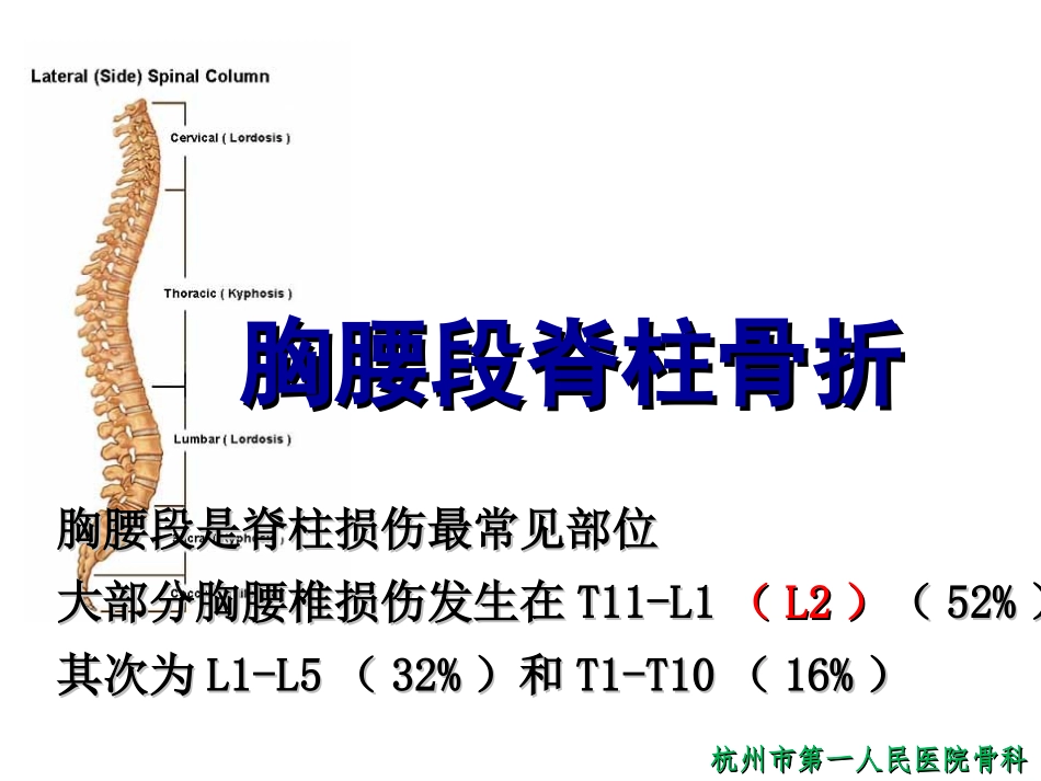 胸腰段脊柱骨折_第2页