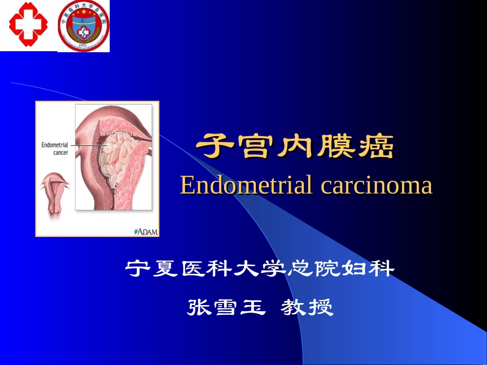 子宫内膜癌(本科)+_第1页