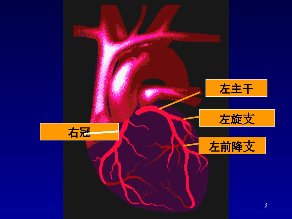 冠心病教学要PPT_第3页