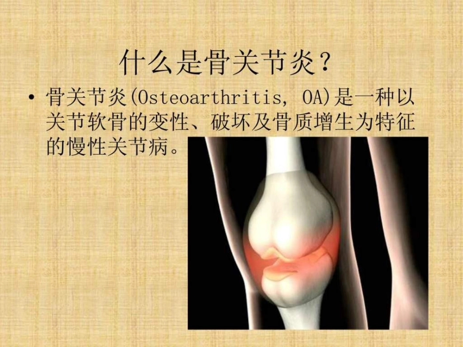 a骨关节炎与骨疏松症_第3页