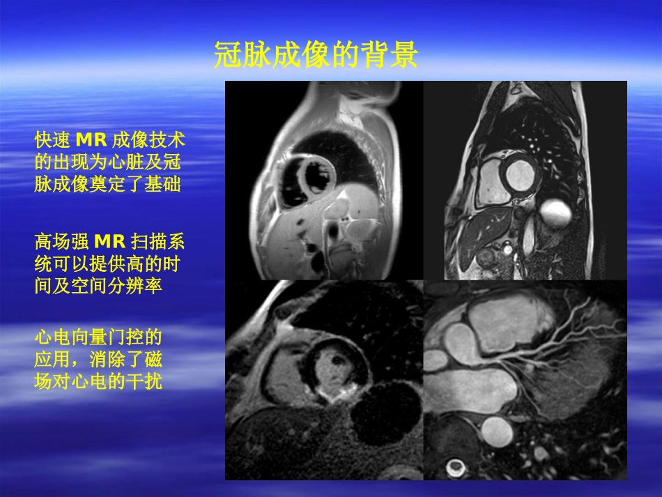 mrca-whole Heart_第2页