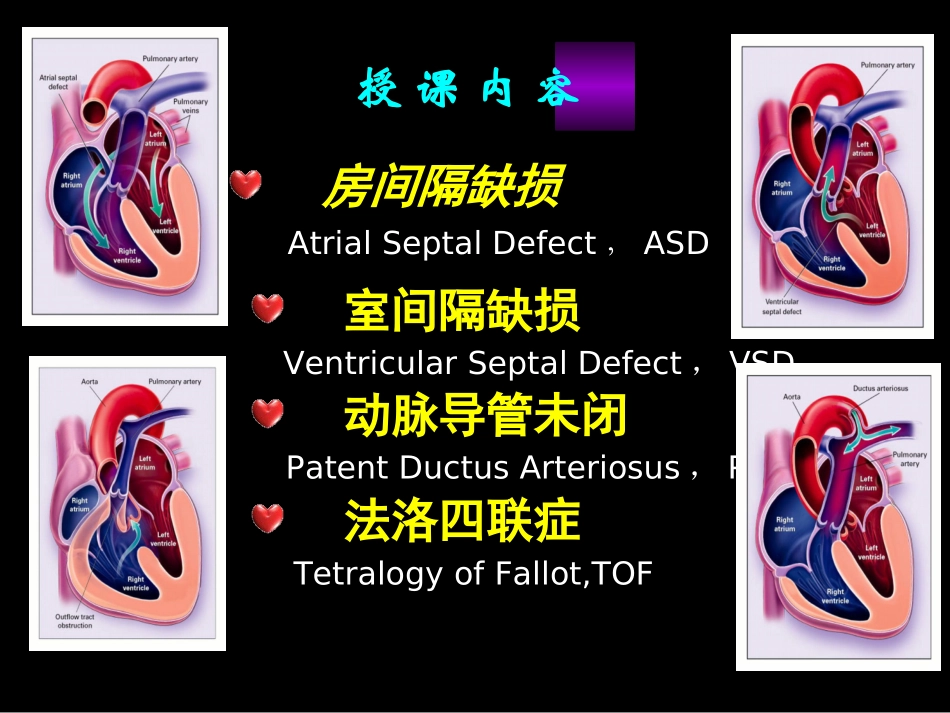 先天性心脏病血液动力学改变_第3页
