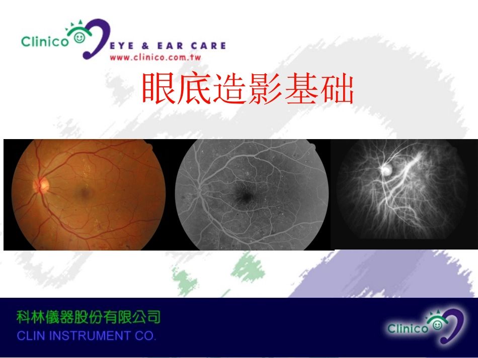 眼底造影基础_第1页