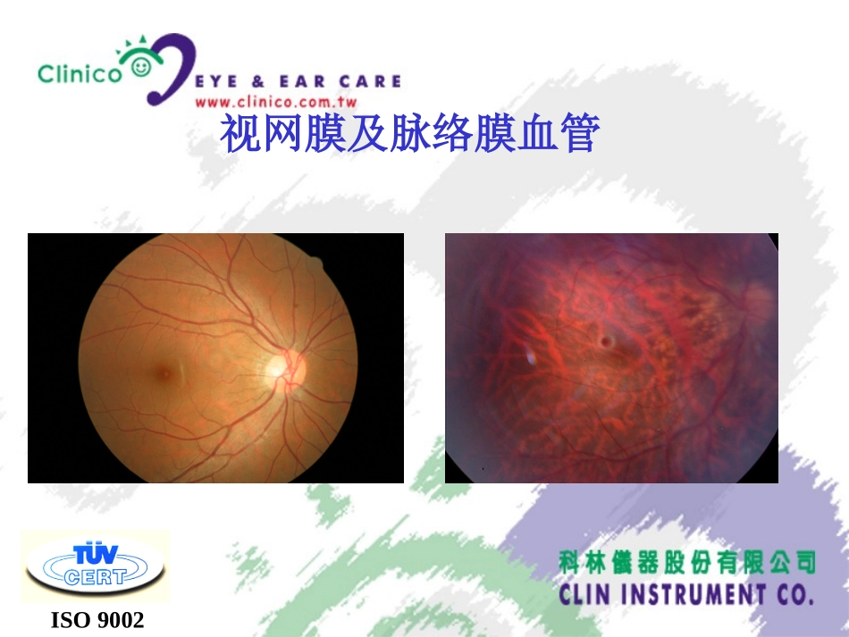 眼底造影基础_第3页