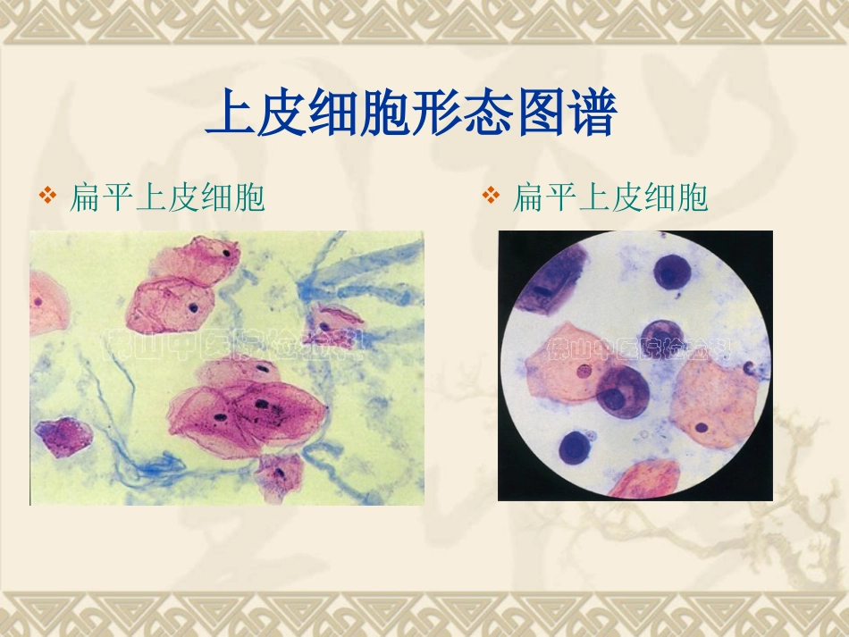 尿沉渣图片整理_第2页