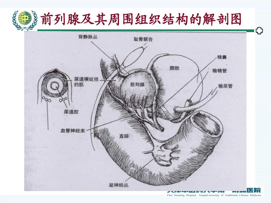 前列腺癌2014新研究概述_第2页