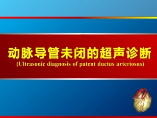 动脉导管未闭、主动脉狭窄超声