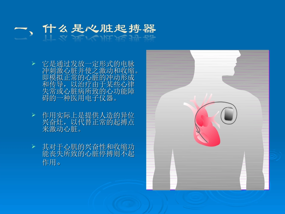 人工心脏起搏器_第3页