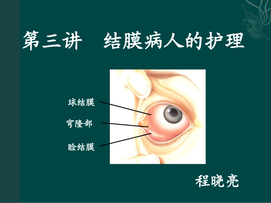 第三讲 结膜病人的护理_第1页