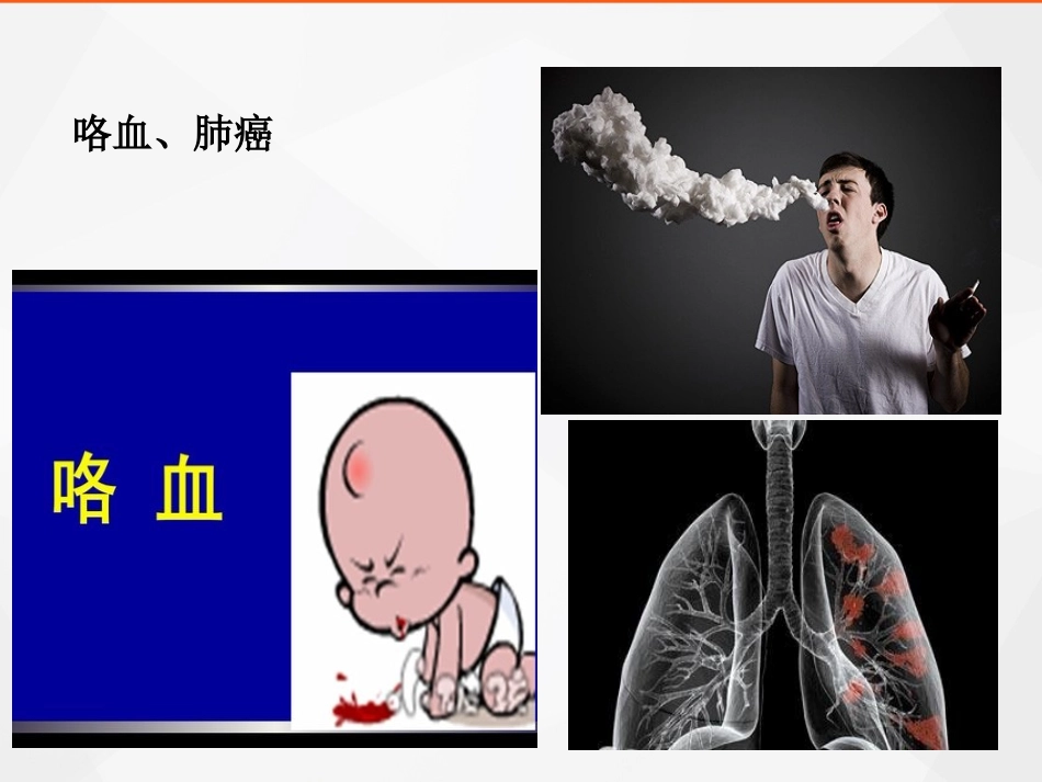 血管介入科门诊(我们关注什么？)_第3页