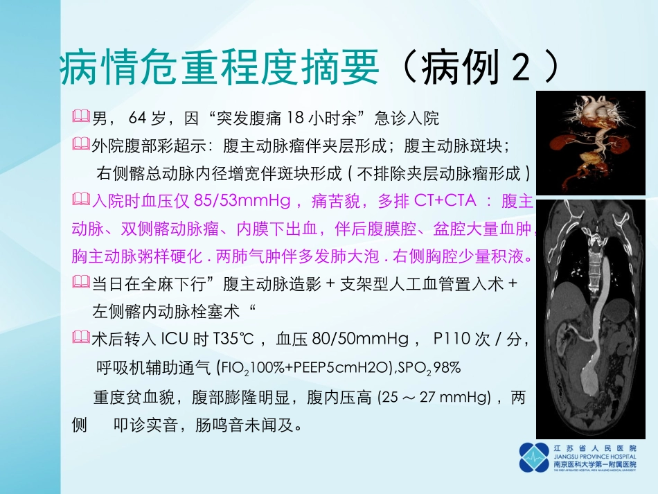 主动脉夹层抢救_第3页