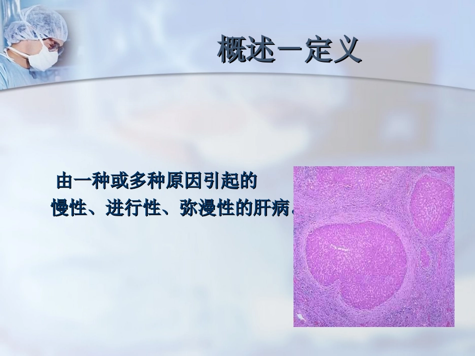 肝硬化[1]_第2页
