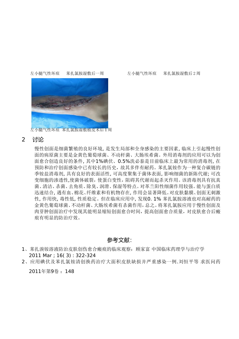 苯扎氯铵溶液在慢性创面及感染肉芽肿的临床应用及观察_第3页
