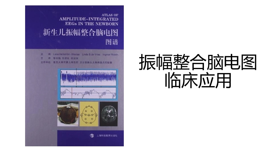 振幅整合脑电图_第1页