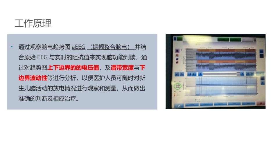 振幅整合脑电图_第3页