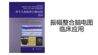 振幅整合脑电图