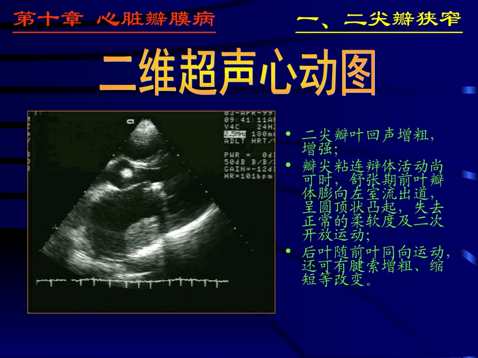 异常心脏ppt_第3页
