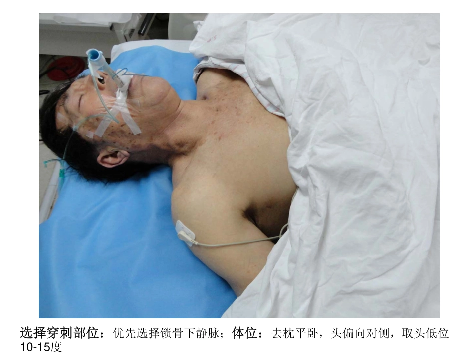 中心静脉导管操作流程图片0228_第3页