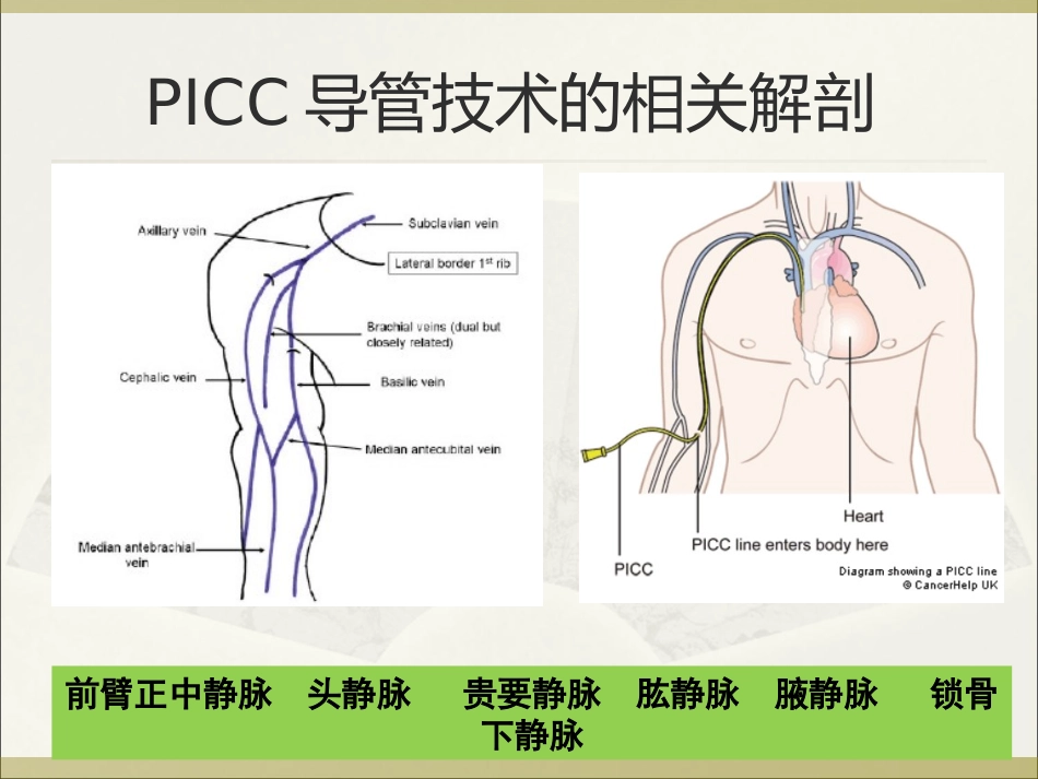 PICC导管头端定位与并发症处理_第3页