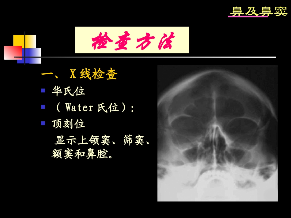 鼻及鼻窦影像诊断_第3页