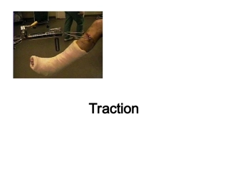 牵引、石膏护理