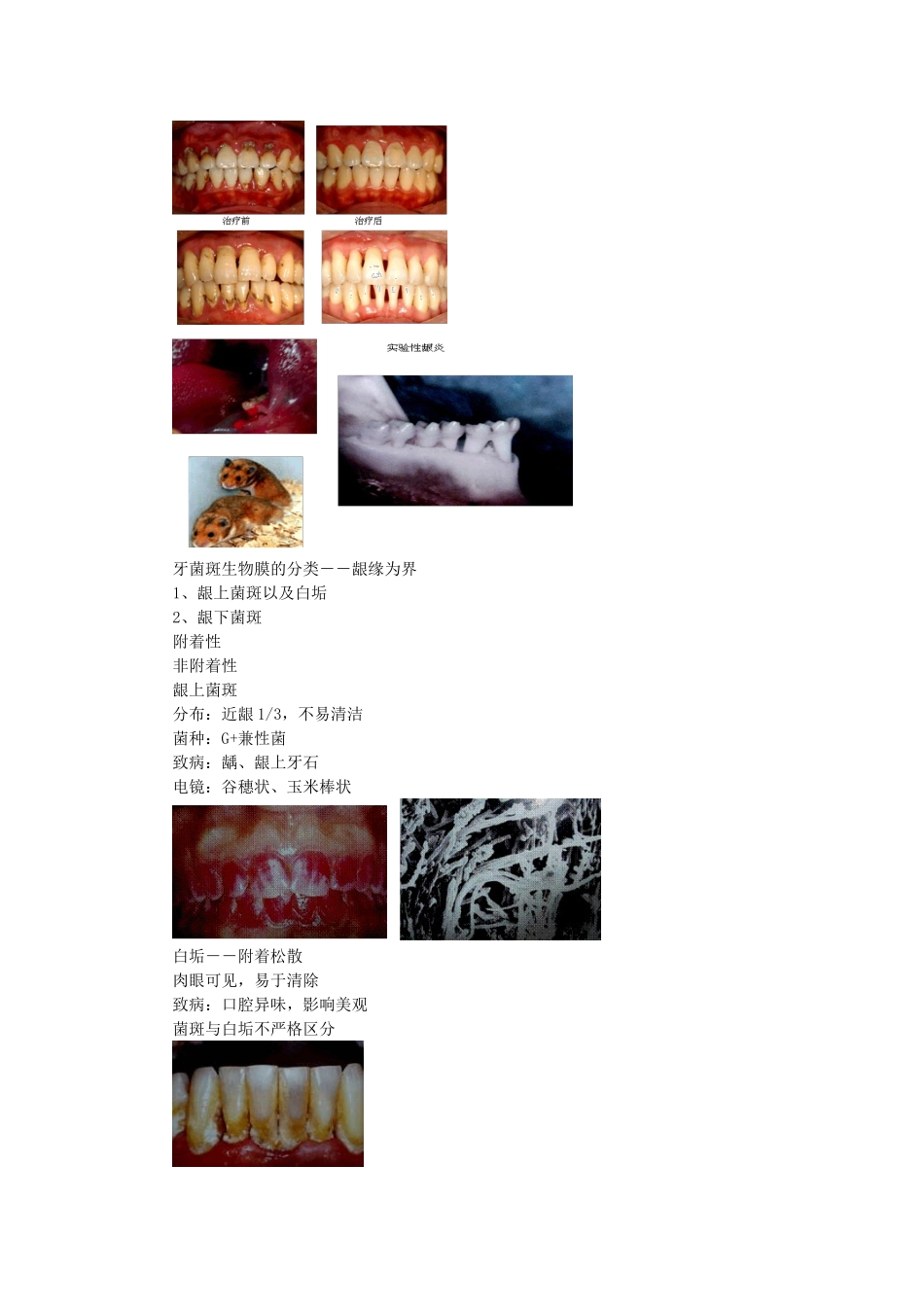 第八章 牙周病学69_第2页