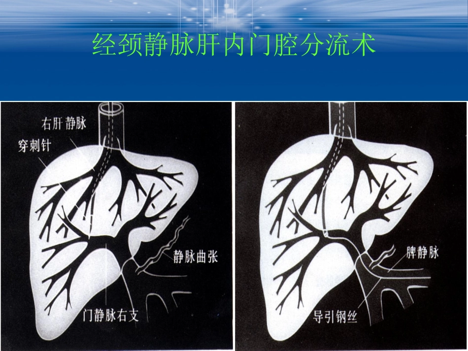 综合介入治疗技术_第3页