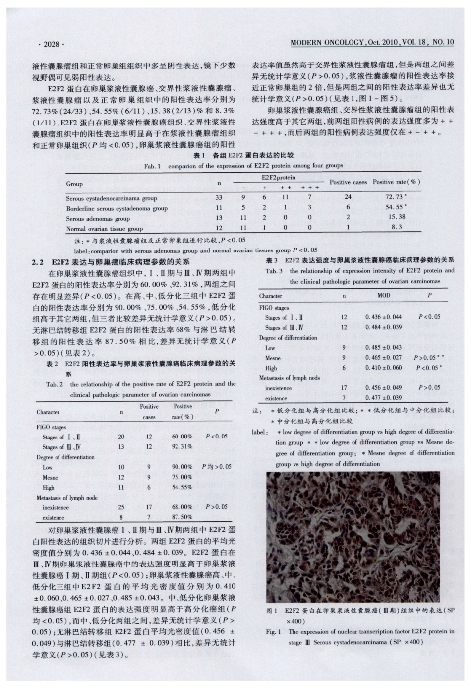 核转录因子E2F2在卵巢浆液性肿瘤组织中的表达及其临床意义_第3页