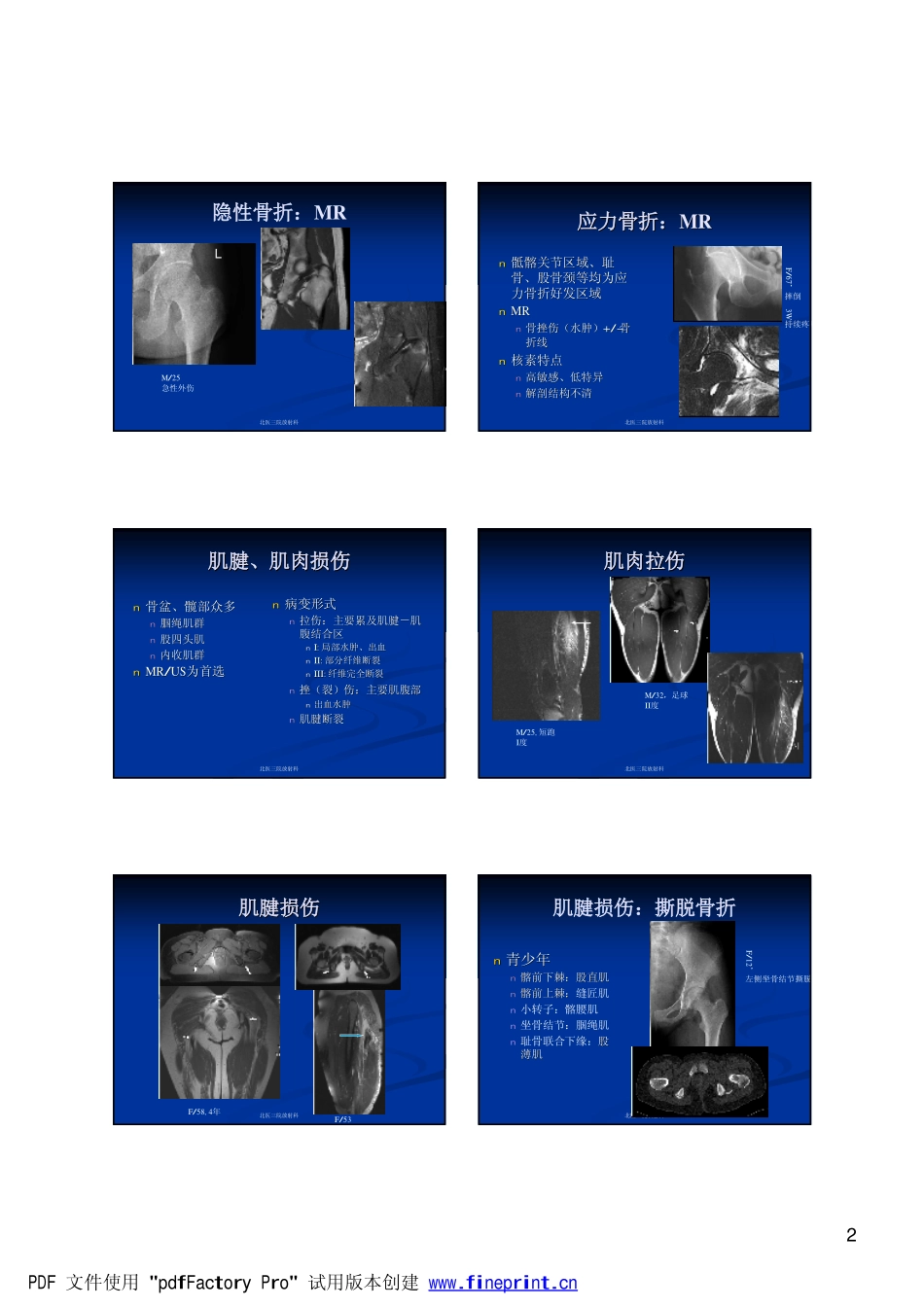 髋关节200887144137729[1]_第2页