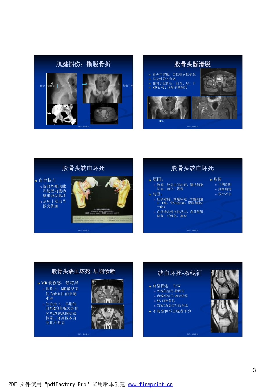 髋关节200887144137729[1]_第3页