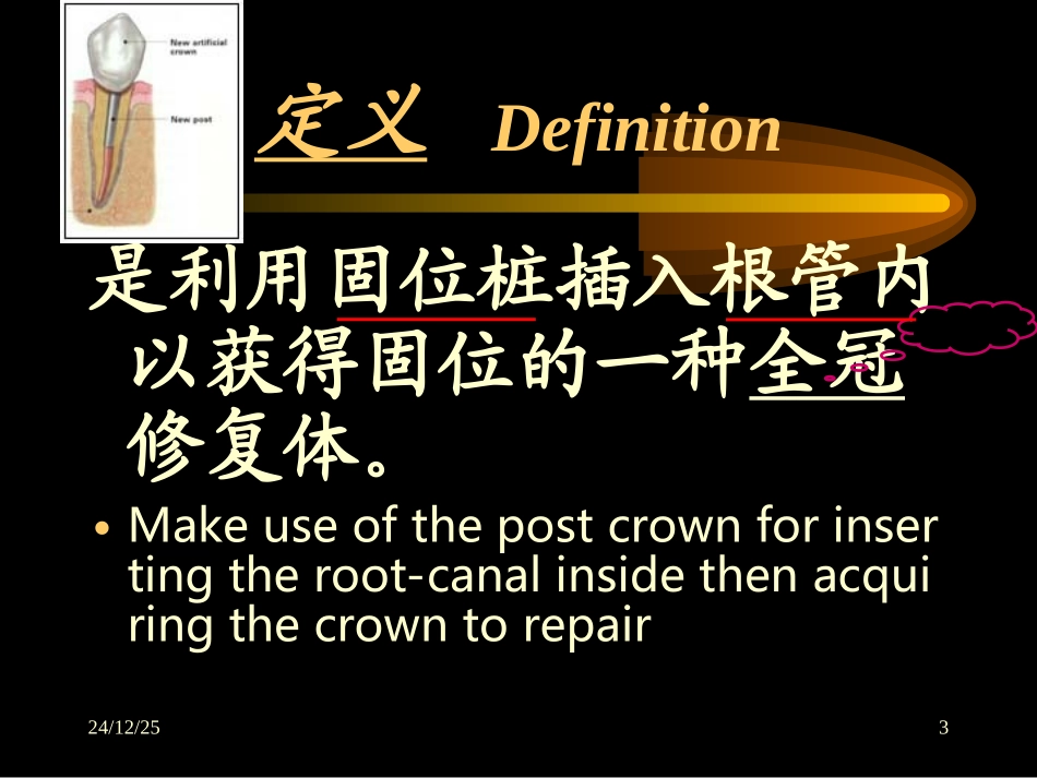 桩冠课件07_第3页
