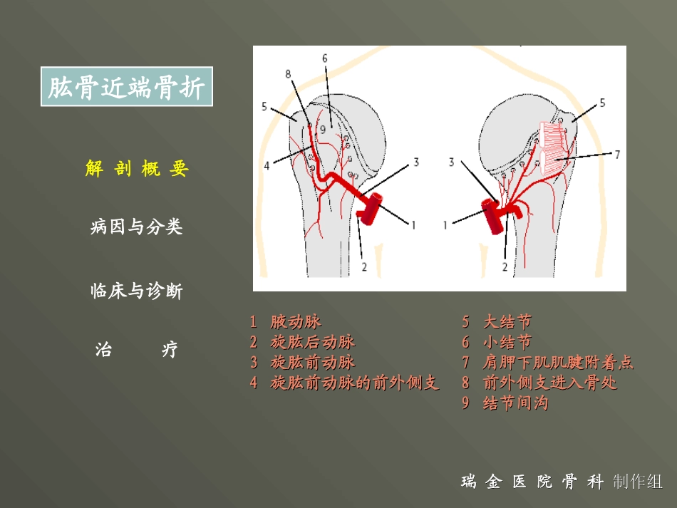 肱骨外科颈骨折_第3页