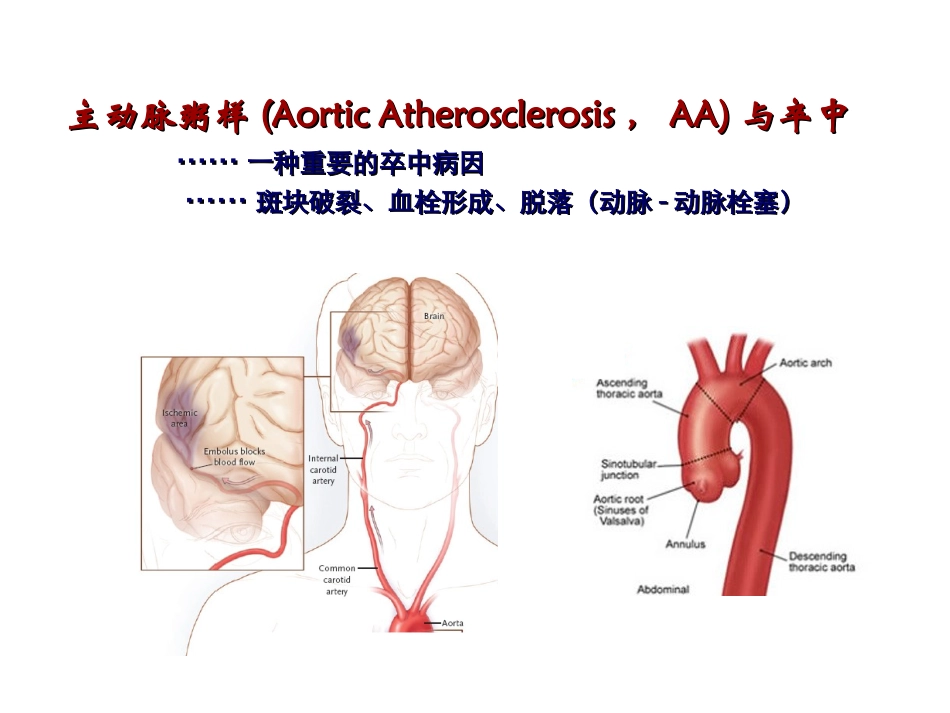 主动脉粥样硬化的诊断与治疗_第3页