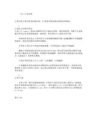 第十讲ST段分析