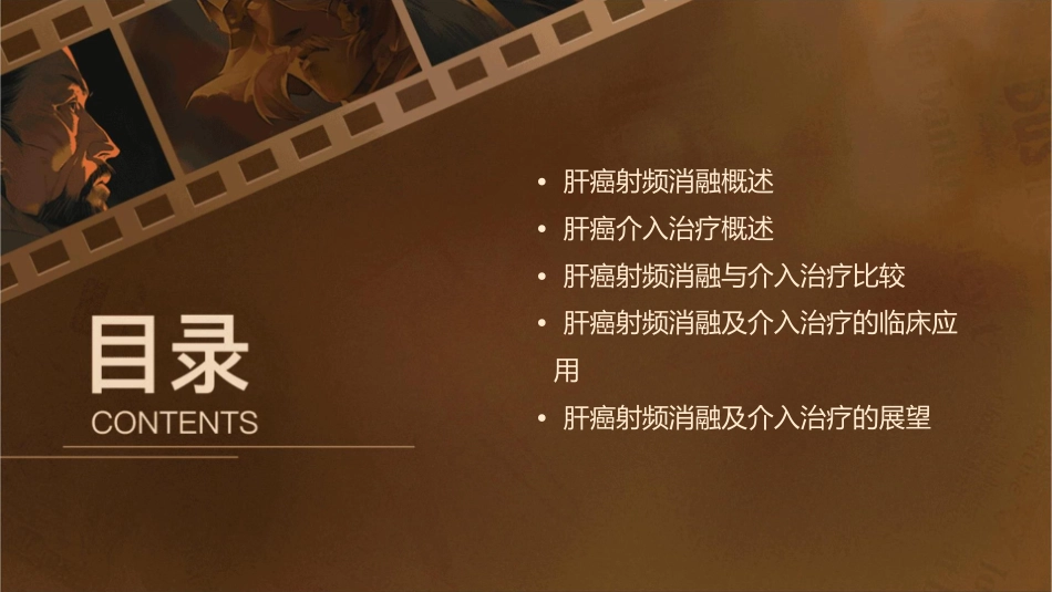 肝癌射频消融及介入治疗课件_第2页