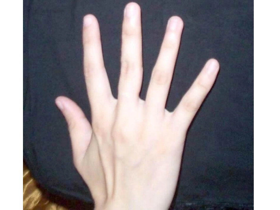 植树问题PPT_第3页