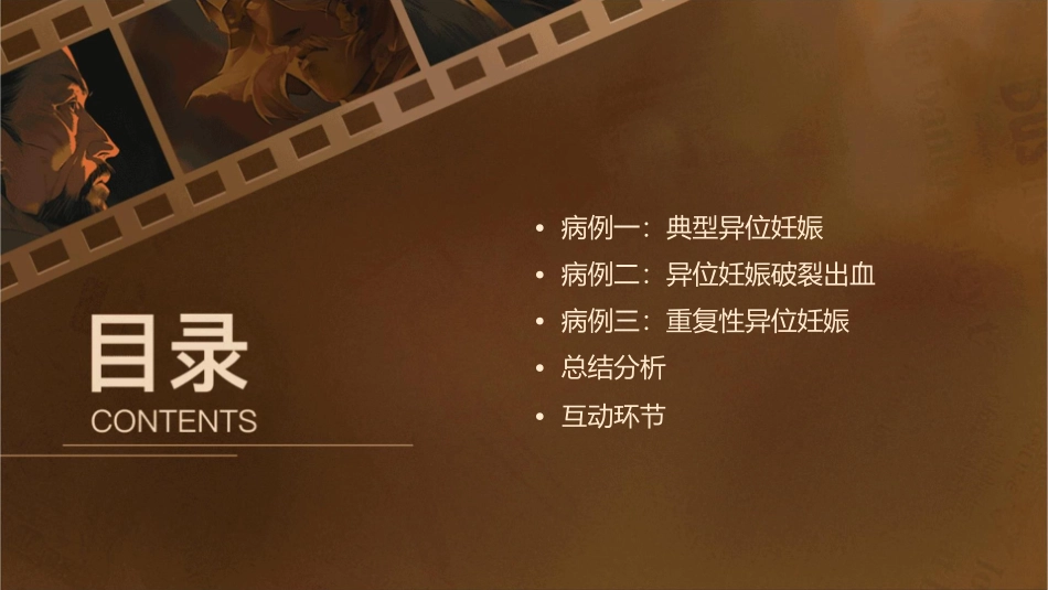 异位妊娠病例讨论课件_第2页