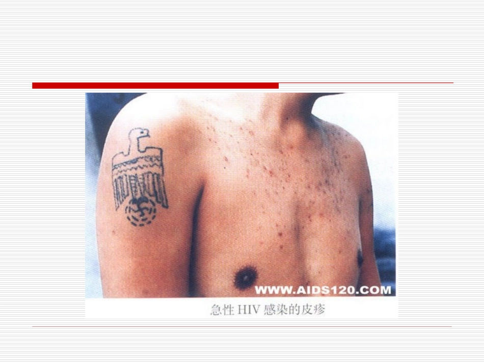 艾滋病防治知识_第3页